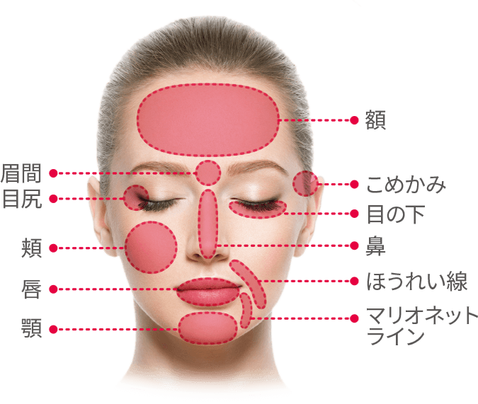 ヒアルロン酸適性部位